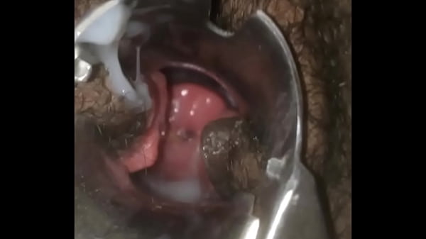 Pregnant open cervix scene