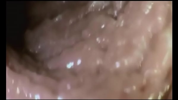 Camera inside of vagina virgin six scene