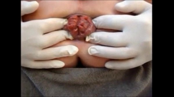 Mature anal stretching prolapse and toys scene